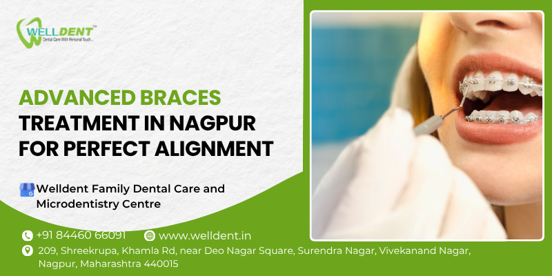 braces treatment in nagpur
