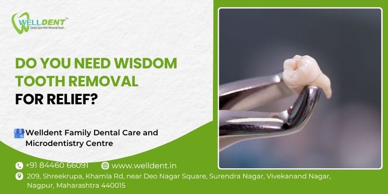 wisdom tooth removal in vivekanand nagar