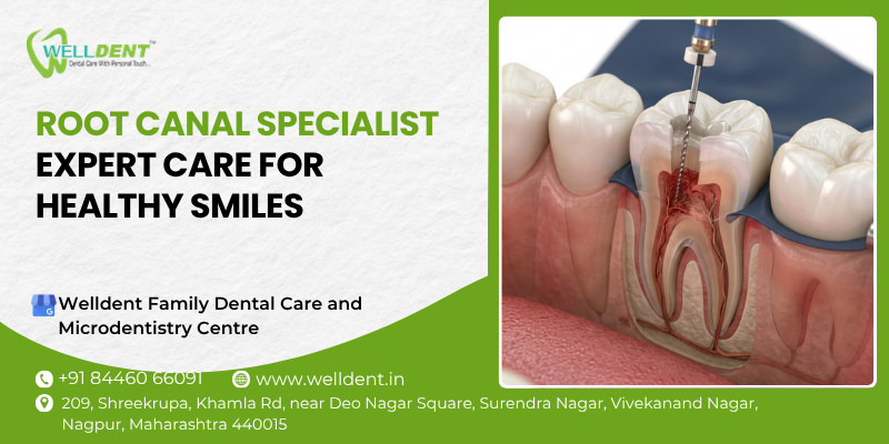 root canal specialist