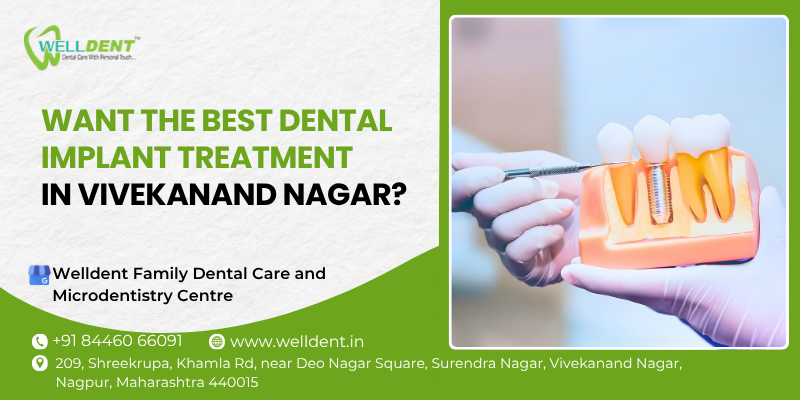 dental implant treatment in vivekanand nagar