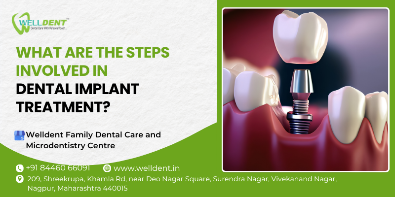 What are the steps involved in dental implant treatment?