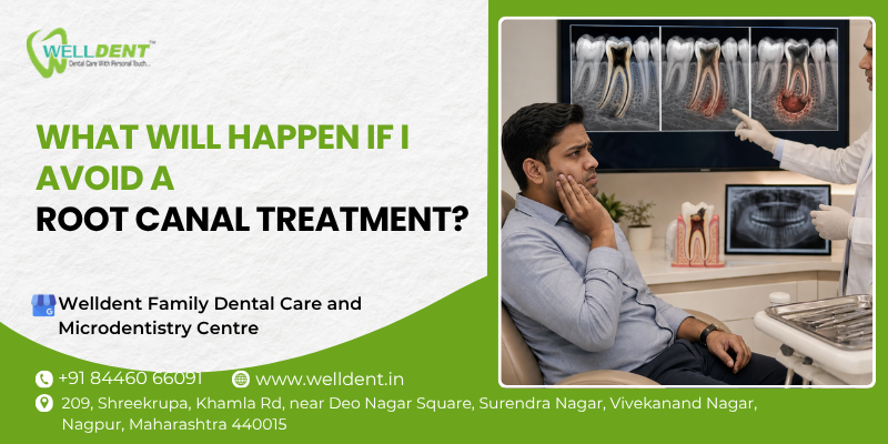 What will happen if I avoid a root canal treatment?
