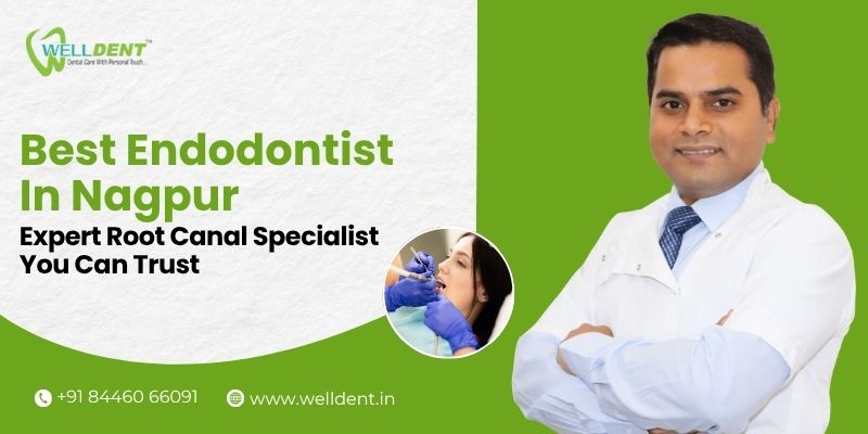 Best Endodontist in Nagpur – Expert Root Canal Specialist You Can Trust
