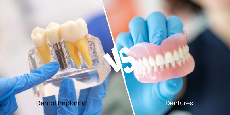 dental implant