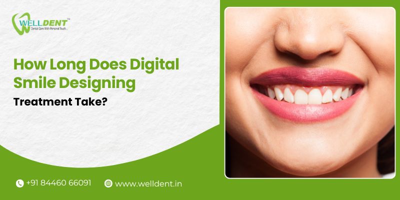 smile designing in Nagpur