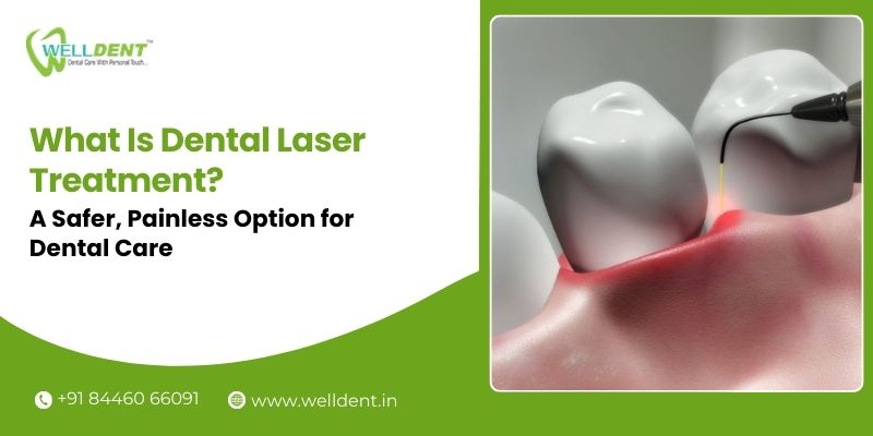 dental laser treatment in Nagpur